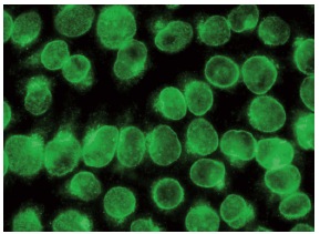  NIPA (B-10): sc-365058. Immunofluorescence staining of methanol-fixed HeLa cells showing nuclear membrane localization.