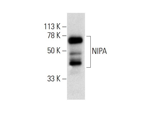  NIPA (B-10): sc-365058. Western blot analysis of NIPA expression in CCD-1064Sk whole cell lysate.