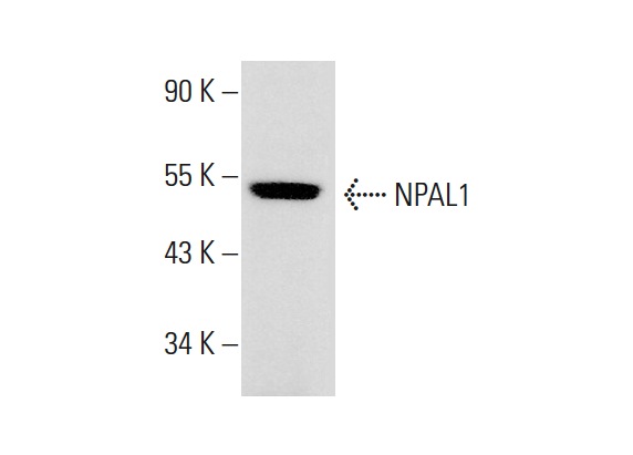  NPAL1 (A-17): sc-248102. Western blot analysis of NPAL1 expression in mouse liver tissue extract.