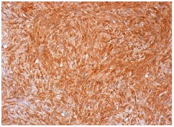  NuMA (E-20): sc-51164. Immunoperoxidase staining of formalin fixed, paraffin-embedded human ovary tissue showing nuclear and cytoplasmic staining of ovarian stroma cells.