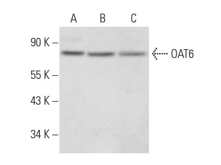  OAT6 (C-14): sc-168815. Western blot analysis of OAT6 expression in HeLa (A), Jurkat (B) and K-562 (C) whole cell lysates.