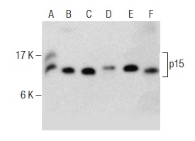  p15 (C-20): sc-612. Western blot analysis of p15 expression in U266 (A), LADMAC (B), KNRK (C), HeLa (D) and JAR (E) whole cell lysates and mouse thymus tissue extract (F).