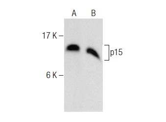  p15 (C-20): sc-612. Western blot analysis of p15 expression in A549 (A) and Raji (B) whole cell lysates.