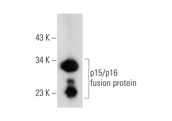  p15 (M-20): sc-1429. Western blot analysis of human recombinant p15 fusion protein.