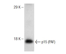  p15 (PAF) (FL-111): sc-67279. Western blot analysis of p15 (PAF) expression in U266 whole cell lysate.