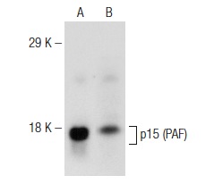  p15 (PAF) (FL-111): sc-67279. Western blot analysis of p15 (PAF) expression in KNRK nuclear extract (A) and M1 whole cell lysate (B).