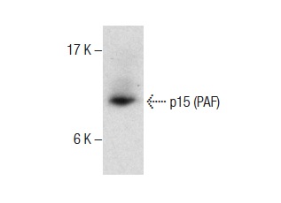  p15 (PAF) (FL-111): sc-67279. Western blot analysis of p15 (PAF) expression in mouse thymus tissue extract.