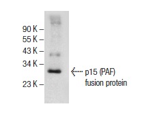  p15 (PAF) (K-15): sc-65163. Western blot analysis of human recombinant p15 (PAF) fusion protein.