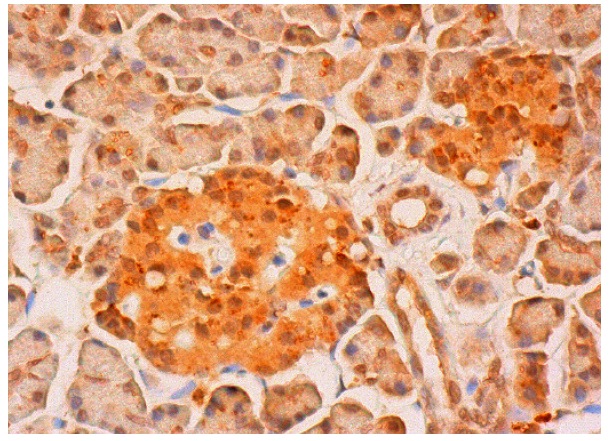  p15 (PAF) (K-15): sc-65163. Immunoperoxidase staining of formalin fixed, paraffin-embedded human pancreas tissue showing nuclear and cytoplasmic staining of exocrine glandular cells and Islets of Langerhans.