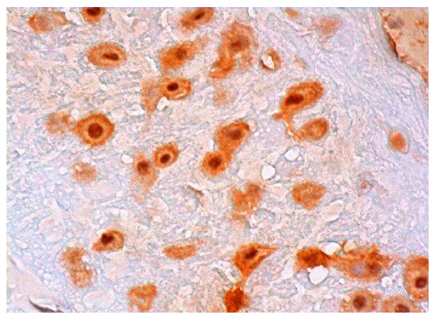  p15 (PAF) (N-14): sc-55968. Immunoperoxidase staining of formalin fixed, paraffin-embedded human placenta tissue showing nuclear and cytoplasmic staining of decidual cells.