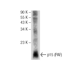  p15 (PAF) (P-15): sc-67922. Western blot analysis of p15 (PAF) expression in mouse thymus tissue extract.