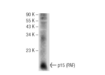  p15 (PAF) (Q-15): sc-67923. Western blot analysis of p15 (PAF) expression in mouse thymus tissue extract.