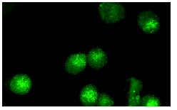  p21 (F-5): sc-6246. Immunofluorescence staining of methanol-fixed knrk cells showing nuclear localization.