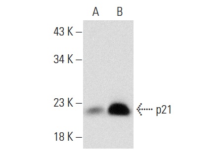  p21 (F-5): sc-6246. Western blot analysis of p21 expression in untreated (A) and Doxorubicin  HCl (Adriamycin) (sc-200923) treated (B) HCT 116 whole cell lysates. Note upregulation of p21 expression in lane B.