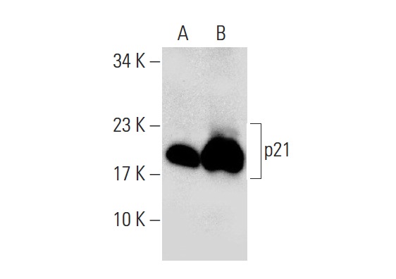  p21 (F-5): sc-6246. Western blot analysis of p21 expression in untreated (A) and SN 38 (sc-203697) treated (B) HCT 116 whole cell lysates. Note upregulation of p21 expression in lane B.