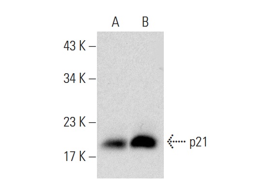  p21 (F-5): sc-6246. Western blot analysis of p21 expression in untreated (A) and Sodium Phenylbutyrate (sc-200652) treated (B) Hep G2 whole cell lysates. Note upregulation of p21 expression in lane B.