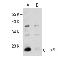  p21 (F-5): sc-6246. Western blot analysis of p21 expression in untreated (A) and Novobiocin Sodium (U-6591) (sc-358734) treated (B) T-47D whole cell lysates. Note down regulation of p21 expression in lane B.