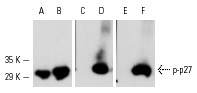  Western blot analysis of mouse recombinant p27 (A,C,E) and mouse recombinant p27 phosphorylated by rat recombinant ERK2 (B,D,F). Antibodies tested include p27 (F-8): sc-1641 (A,B), p-p27 (Ser 10)-R: sc-12939-R (C,D) and p-p27 (Thr 187)-R: sc-16324-R (E,F).