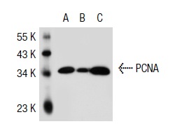  PCNA (PC5): sc-53408. Western blot analysis of PCNA expression in non-transfected 293T: sc-117752 (A), mouse PCNA transfected 293T: sc-127307 (B) and A-431 (C) whole cell lysates.