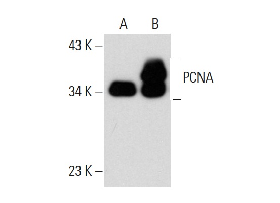  PCNA (PC5): sc-53408. Western blot analysis of PCNA expression in non-transfected: sc-117752 (A) and human PCNA transfected: sc-159920 (B) 293T whole cell lysates.