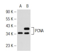  PCNA (PC5): sc-53408. Western blot analysis of PCNA expression in non-transfected: sc-117752 (A) and human PCNA transfected: sc-170834 (B) 293T whole cell lysates.