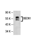  BECN1 (E-8): sc-48341. Western blot analysis of BECN1 expression in MCF7 whole cell lysate.