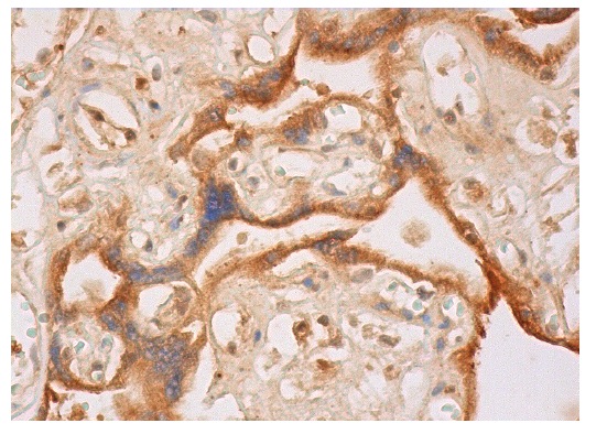  Pericentrin 2 (H-140): sc-68928. Immunoperoxidase staining of formalin fixed, paraffin-embedded human placenta tissue showing cytoplasmic staining of trophoblastic cells.