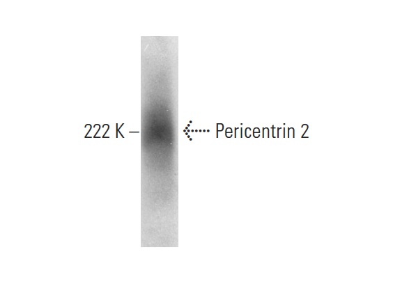  Pericentrin 2 (M-208): sc-68929. Western blot analysis of Pericentrin 2 expression in Hep G2 whole cell lysate.