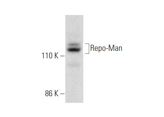  Repo-Man (M-300): sc-134951. Western blot analysis of Repo-Man expression in RT-4 whole cell lysate.