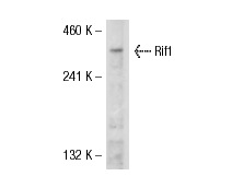  Rif1 (Y-18): sc-65196. Western blot analysis of Rif1 expression in HeLa whole cell lysate.