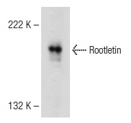  Rootletin (C-2): sc-374056. Western blot analysis of Rootletin expression in Y79 nuclear extract.