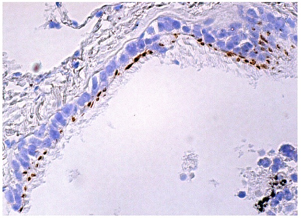  Rootletin (C-2): sc-374056. Immunoperoxidase staining of formalin fixed, paraffin-embedded human bronchus tissue showing membrane staining of respiratory epithelial cells.