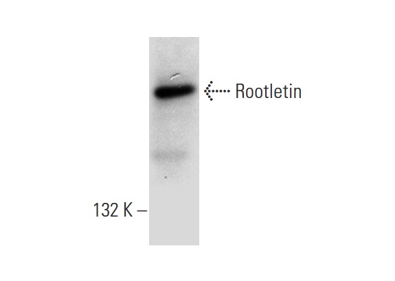  Rootletin (C-2): sc-374056. Western blot analysis of Rootletin expression in Daoy whole cell lysate.