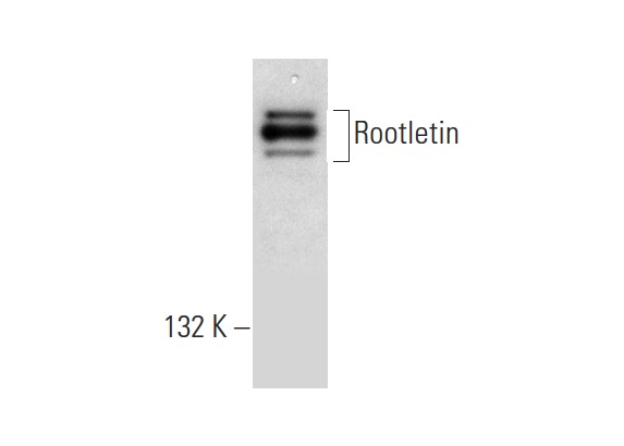  Rootletin (E-5): sc-390720. Western blot analysis of Rootletin expression in Y79 nuclear extract.