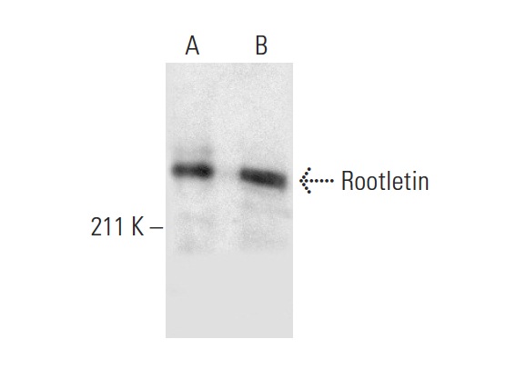  Rootletin (E-5): sc-390720. Western blot analysis of Rootletin expression in Y79 nuclear extract (A) and Daoy whole cell lysate (B).