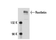  Rootletin (C-20): sc-67824. Western blot analysis of Rootletin expression in Y79 nuclear extract.