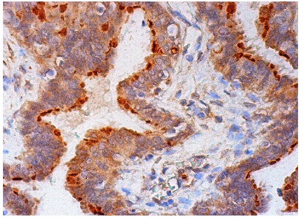  Rootletin (C-20): sc-67824. Immunoperoxidase staining of formalin fixed, paraffin-embedded human fallopian tube tissue showing cytoplasmic staining of ciliated cells.