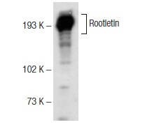  Rootletin (H-84): sc-135275. Western blot analysis of Rootletin expression in Y79 nuclear extract.