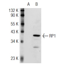  RP1 (P-20): sc-19549. Western blot analysis of RP1 expression in non-transfected: sc-117752 (A) and mouse RP1 transfected: sc-123259 (B) 293T whole cell lysates.