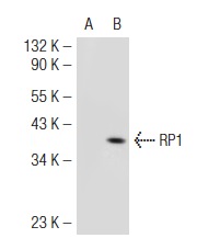  RP1 (P-20): sc-19549. Western blot analysis of RP1 expression in non-transfected: sc-117752 (A) and mouse RP1 transfected: sc-123260 (B) 293T whole cell lysates.