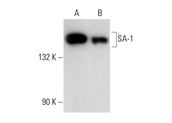  SA-1 (A-9): sc-365061. Western blot analysis of SA-1 expression in HEL 92.1.7 (A) and HuT 78 (B) whole cell lysates.