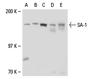  SA-1 (D-20): sc-54515. Western blot analysis of SA-1 expression in Hs 67 (A) and HuT 78 (B) whole cell lysates and HEL 92.1.7 nuclear extract (C) and mouse spleen (D) and mouse thymus (E) tissue extracts.