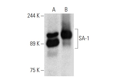  SA-1 (D-20): sc-54515. Western blot analysis of SA-1 expression in HEL 92.1.7 (A) and HuT 78 (B) whole cell lysates.