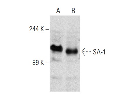  SA-1 (H-86): sc-135072. Western blot analysis of SA-1 expression in HEL 92.1.7 (A) and HuT 78 (B) whole cell lysates.