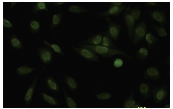  SA-1 (LL-16): sc-81851. Immunofluorescence staining of paraformaldehyde-fixed HeLa cells showing nuclear localization.