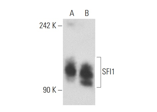  SFI1 (C-16): sc-86859. Western blot analysis of SFI1 expression in non-transfected: sc-117752 (A) and human SFI1 transfected: sc-112126 (B) 293T whole cell lysates.