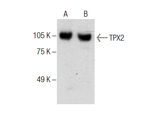  TPX2 (B-10): sc-390183. Western blot analysis of TPX2 expression in Jurkat (A) and KNRK (B) whole cell lysates.