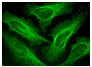  TPX2 (B-5): sc-376812. Immunofluorescence staining of methanol-fixed HeLa cells showing cytoplasmic localization.