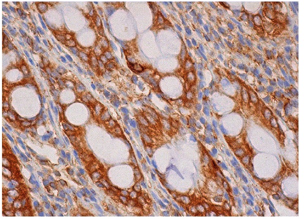  TPX2 (B-5): sc-376812. Immunoperoxidase staining of formalin fixed, paraffin-embedded human rectum tissue showing cytoplasmic staining of glandular cells.