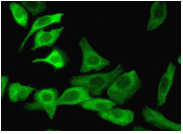  TPX2 (E-2): sc-271570. Immunofluorescence staining of formalin-fixed HeLa cells showing cytoplasmic localization. Kindly provided by Yang Xiang, Ph.D., Division of Newborn Medicine, Boston Childrens Hospital, Cell Biology Department, Harvard Medical School.